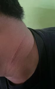 Pengguna Jalan di Tidar IV Resah, Benang Layangan Diduga Picu Bahaya Serius