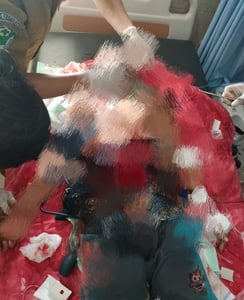 Pria di Cempaga Hulu Ditemukan Tewas dengan Luka Parah, Diduga Akhiri Hidup Sendiri