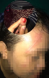 Korban Tali Layangan di Sampit Terus Bertambah!