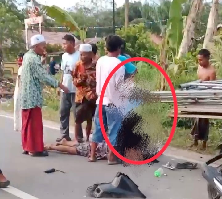 <p>Kondisi bocah yang tertancap besi tenda (Foto: Ist) </p>

